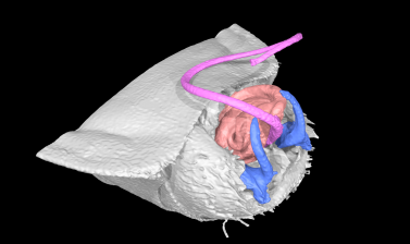 Three-dimensional computer reconstruction of the male genitals of a modern seed bug