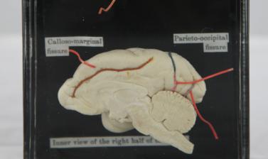 Liontailed Macaque Brain Before Treatment