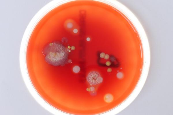 Petri dish bacteria